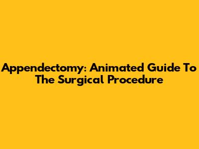 Appendectomy: Animated Guide To The Surgical Procedure