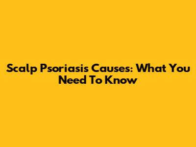 Scalp Psoriasis Causes: What You Need To Know
